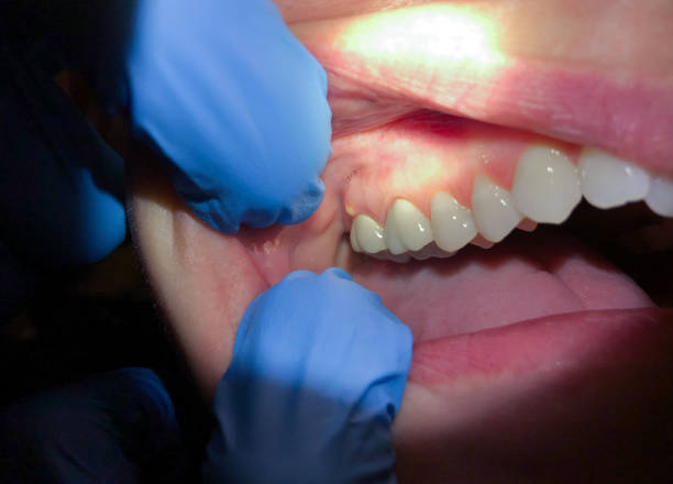 Best Orthodontic Emergency Dentist in Bertsch Oceanview, CA