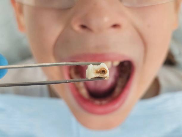 Best Weekend Emergency Dentist in Bertsch Oceanview, CA